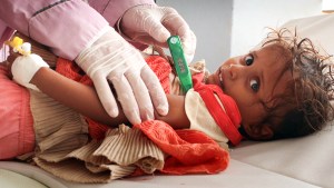 CHOLERA,YEMEN