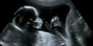 Can abortion be forgiven in the Catholic Church?
