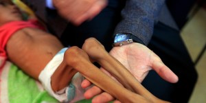 Famine could engulf Yemen, says UN humanitarian chief