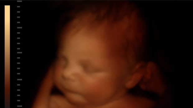 bebe-utero.jpg