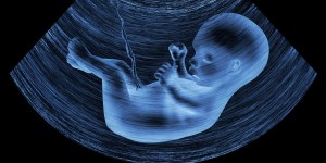 Arizona reinstates 1864 ban on all abortions with one exception