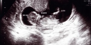 15 Facts about the 15-week-gestation fetus