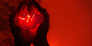 Report finds 25,000 fewer U.S. abortions after Dobbs